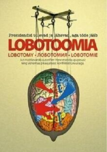 Лоботомия
